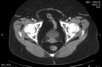 Emergency diagnosis challenge: abdominal pain, surgical?