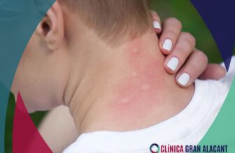 Types of insect bites